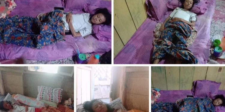 Kondisi Sangat Memprihatinkan, Pemi Lia (23) Warga Pasar Tengah Kepahiang Butuh Bantuan